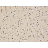 Immunohistochemistry - SIRT1 Antibody from Signalway Antibody (32029) - Antibodies.com
