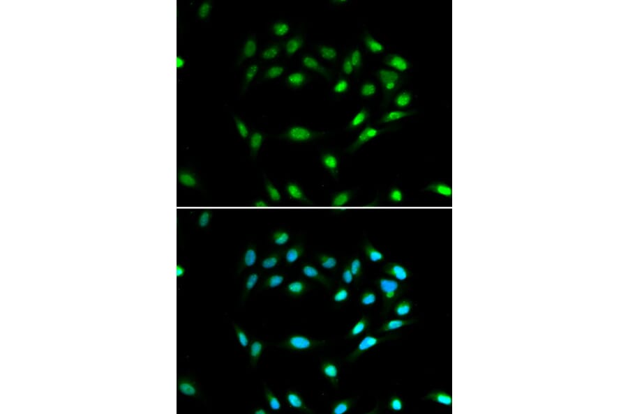 Immunofluorescence - SIRT1 Antibody from Signalway Antibody (32029) - Antibodies.com