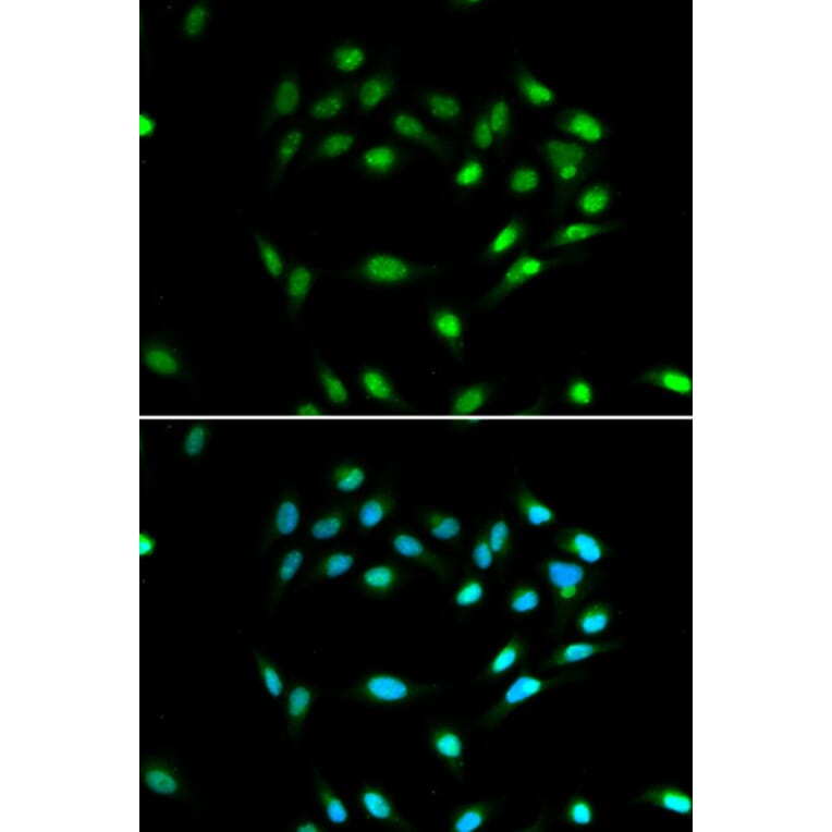 Immunofluorescence - SIRT1 Antibody from Signalway Antibody (32029) - Antibodies.com