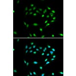 Immunofluorescence - SIRT1 Antibody from Signalway Antibody (32029) - Antibodies.com
