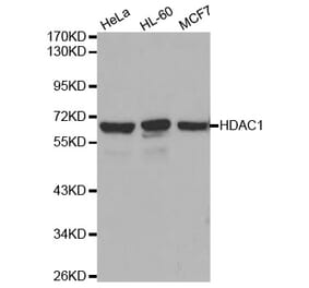 Western blot - HDAC1 Antibody from Signalway Antibody (32034) - Antibodies.com