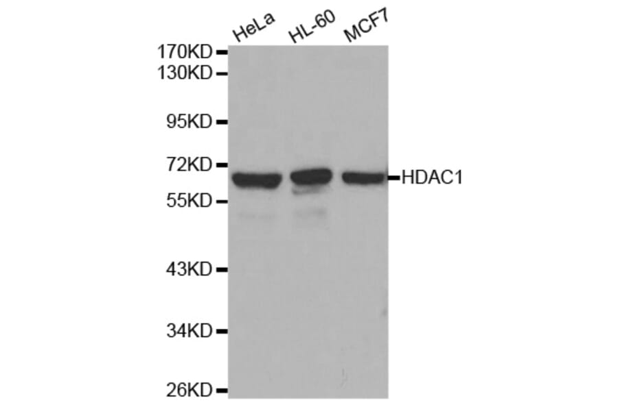 Western blot - HDAC1 Antibody from Signalway Antibody (32034) - Antibodies.com