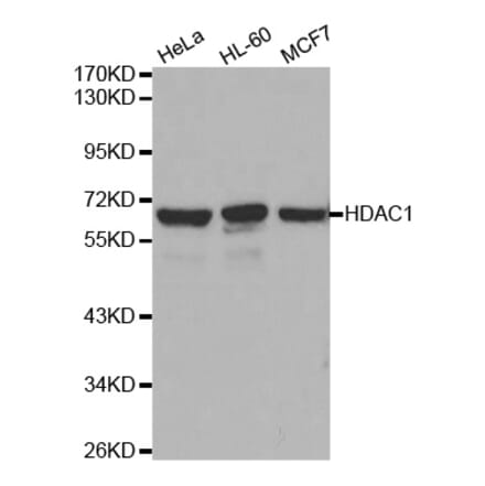 Western blot - HDAC1 Antibody from Signalway Antibody (32034) - Antibodies.com