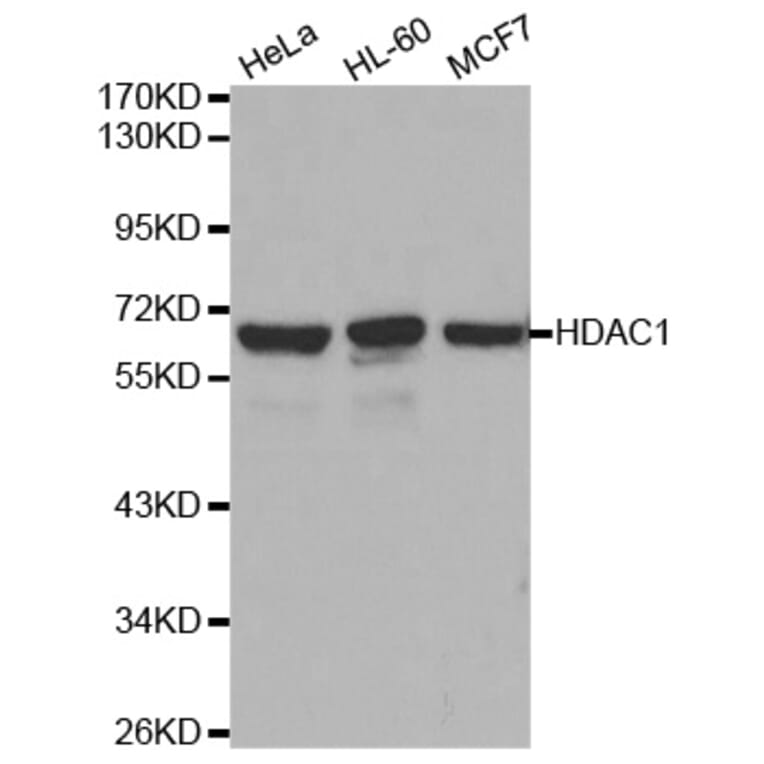 Western blot - HDAC1 Antibody from Signalway Antibody (32034) - Antibodies.com