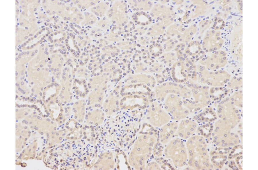 Immunohistochemistry - HDAC1 Antibody from Signalway Antibody (32034) - Antibodies.com