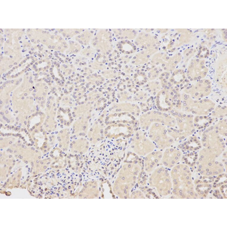 Immunohistochemistry - HDAC1 Antibody from Signalway Antibody (32034) - Antibodies.com
