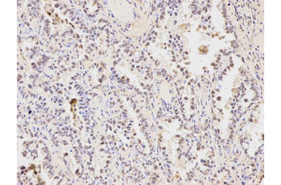 Immunohistochemistry - HDAC1 Antibody from Signalway Antibody (32034) - Antibodies.com