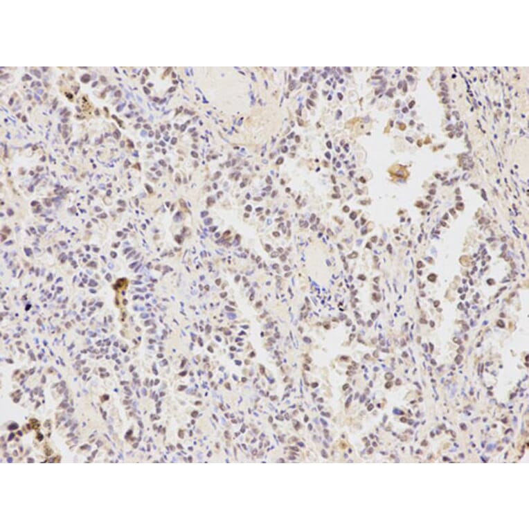 Immunohistochemistry - HDAC1 Antibody from Signalway Antibody (32034) - Antibodies.com