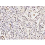 Immunohistochemistry - HDAC1 Antibody from Signalway Antibody (32034) - Antibodies.com