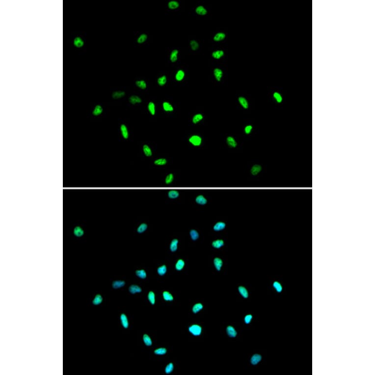 Immunofluorescence - HDAC1 Antibody from Signalway Antibody (32034) - Antibodies.com