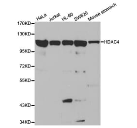 Western blot - HDAC4 Antibody from Signalway Antibody (32035) - Antibodies.com