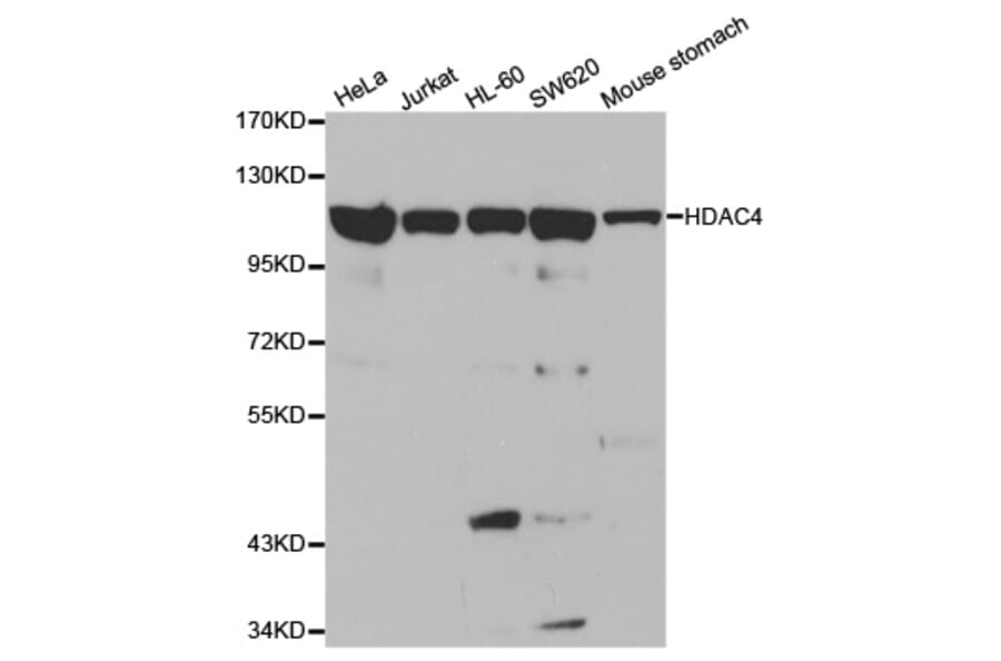 Western blot - HDAC4 Antibody from Signalway Antibody (32035) - Antibodies.com