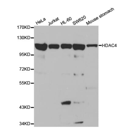Western blot - HDAC4 Antibody from Signalway Antibody (32035) - Antibodies.com