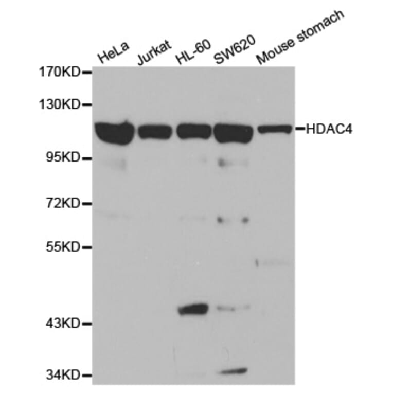 Western blot - HDAC4 Antibody from Signalway Antibody (32035) - Antibodies.com