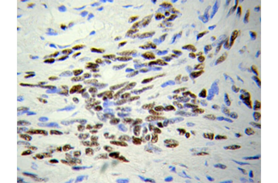 Immunohistochemistry - HDAC4 Antibody from Signalway Antibody (32035) - Antibodies.com