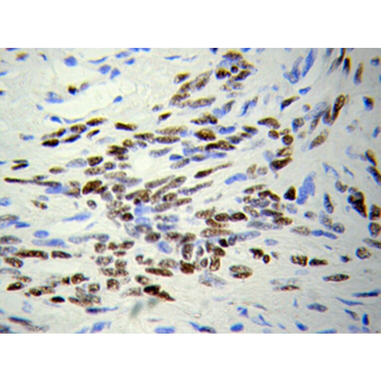 Immunohistochemistry - HDAC4 Antibody from Signalway Antibody (32035) - Antibodies.com