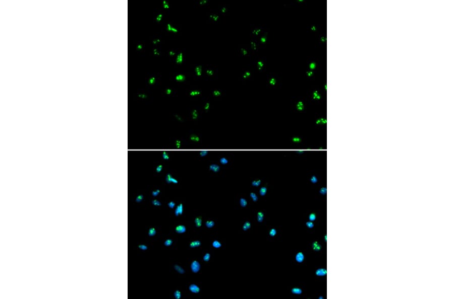 Immunofluorescence - HDAC4 Antibody from Signalway Antibody (32035) - Antibodies.com