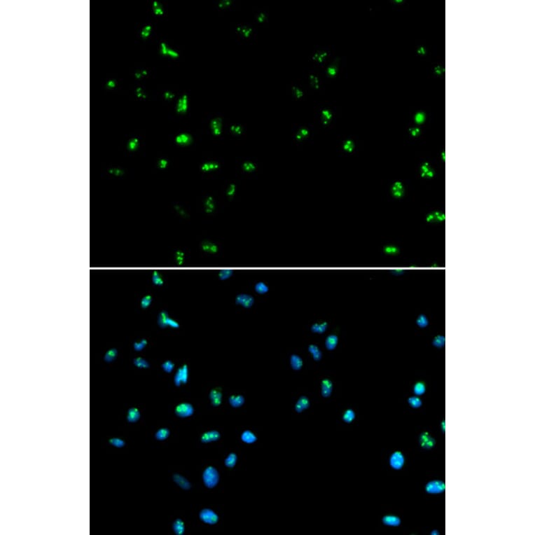 Immunofluorescence - HDAC4 Antibody from Signalway Antibody (32035) - Antibodies.com