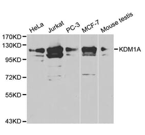 Western blot - KDM1A Antibody from Signalway Antibody (32188) - Antibodies.com