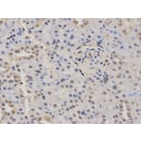 Immunohistochemistry - KDM1A Antibody from Signalway Antibody (32188) - Antibodies.com