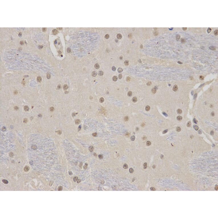 Immunohistochemistry - KDM1A Antibody from Signalway Antibody (32188) - Antibodies.com
