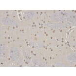 Immunohistochemistry - KDM1A Antibody from Signalway Antibody (32188) - Antibodies.com