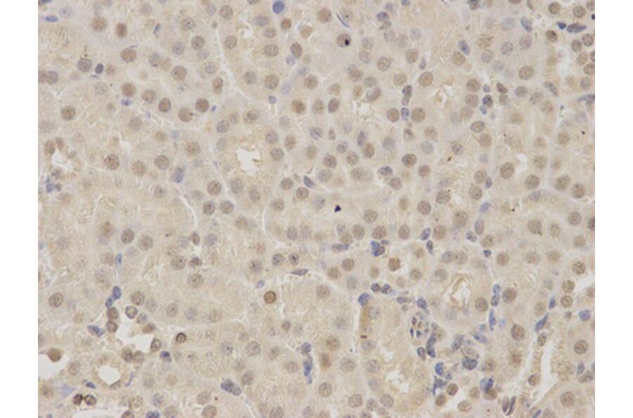 Immunohistochemistry - KDM1A Antibody from Signalway Antibody (32188) - Antibodies.com