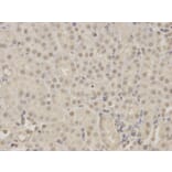 Immunohistochemistry - KDM1A Antibody from Signalway Antibody (32188) - Antibodies.com
