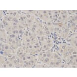Immunohistochemistry - KDM1A Antibody from Signalway Antibody (32188) - Antibodies.com