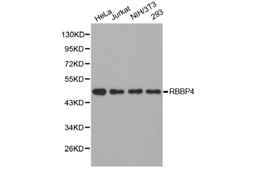 Western blot - RBBP4 Antibody from Signalway Antibody (32290) - Antibodies.com