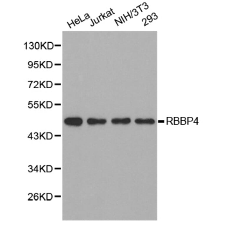 Western blot - RBBP4 Antibody from Signalway Antibody (32290) - Antibodies.com