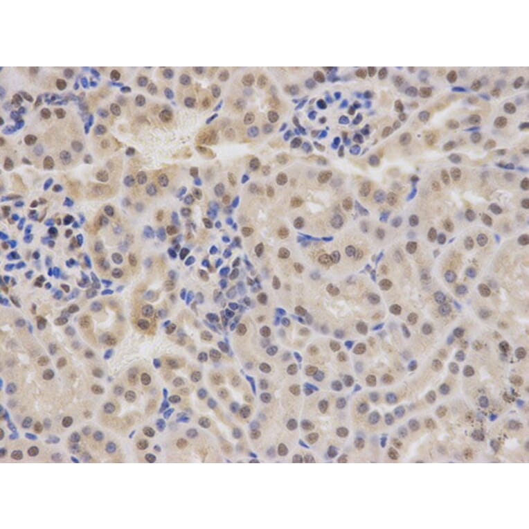 Immunohistochemistry - RBBP4 Antibody from Signalway Antibody (32290) - Antibodies.com