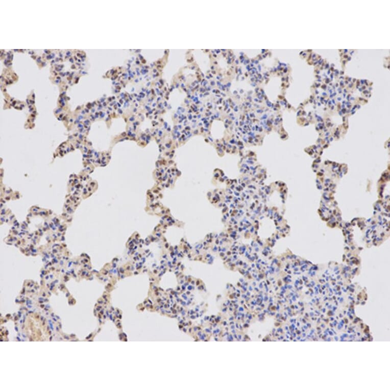 Immunohistochemistry - RBBP4 Antibody from Signalway Antibody (32290) - Antibodies.com