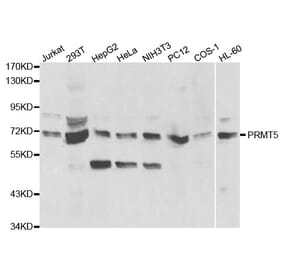 Western blot - PRMT5 Antibody from Signalway Antibody (32297) - Antibodies.com