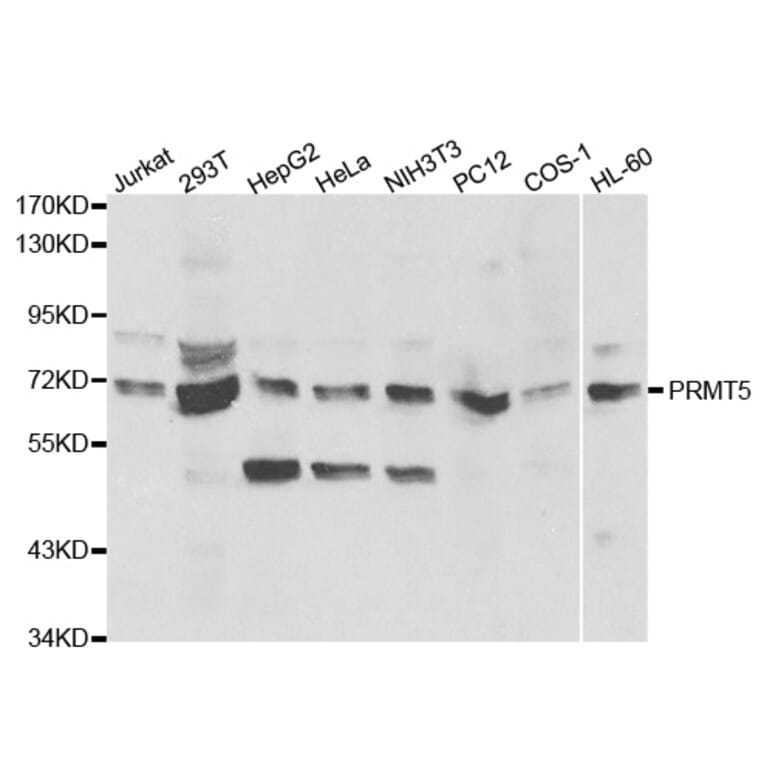 Western blot - PRMT5 Antibody from Signalway Antibody (32297) - Antibodies.com