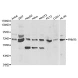 Western blot - PRMT5 Antibody from Signalway Antibody (32297) - Antibodies.com