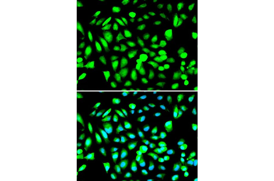 Immunofluorescence - PRMT5 Antibody from Signalway Antibody (32297) - Antibodies.com