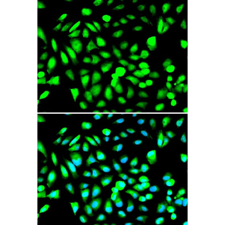 Immunofluorescence - PRMT5 Antibody from Signalway Antibody (32297) - Antibodies.com