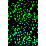 Immunofluorescence - PRMT5 Antibody from Signalway Antibody (32297) - Antibodies.com
