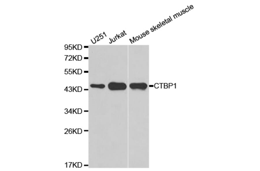Western blot - CTBP1 Antibody from Signalway Antibody (32397) - Antibodies.com
