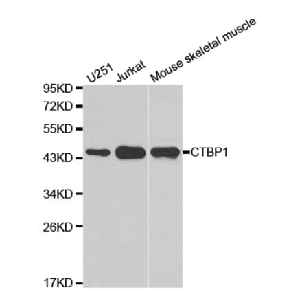 Western blot - CTBP1 Antibody from Signalway Antibody (32397) - Antibodies.com