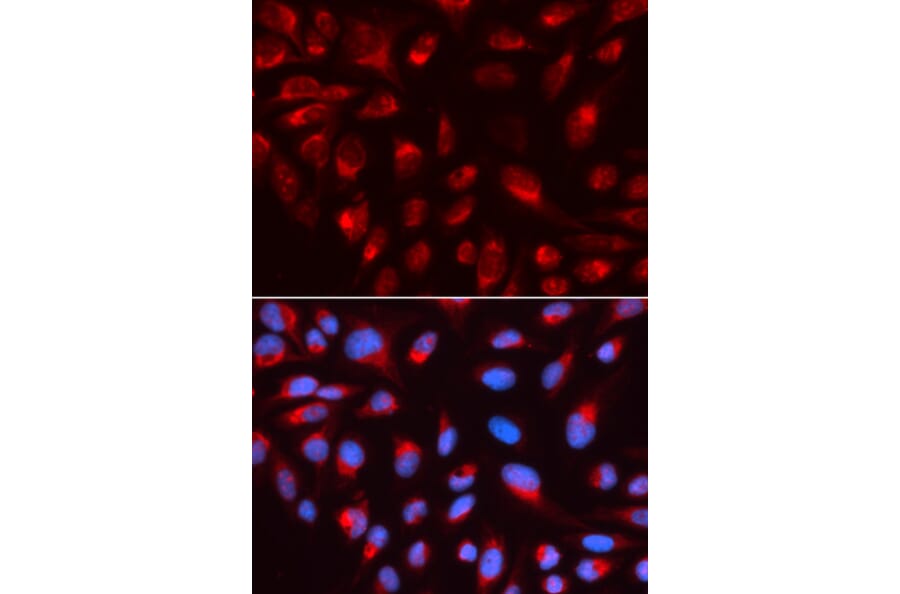 Immunofluorescence - CTBP1 Antibody from Signalway Antibody (32397) - Antibodies.com