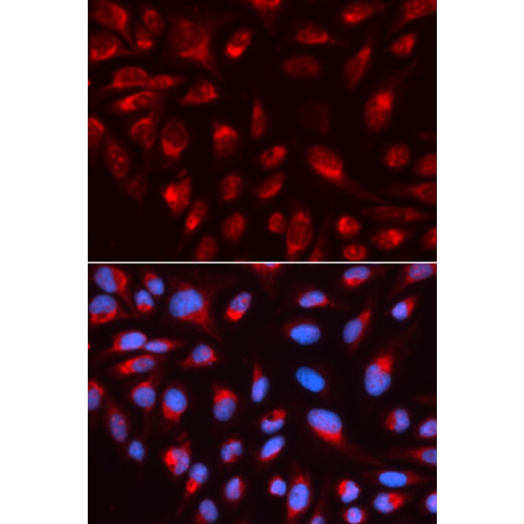 Immunofluorescence - CTBP1 Antibody from Signalway Antibody (32397) - Antibodies.com