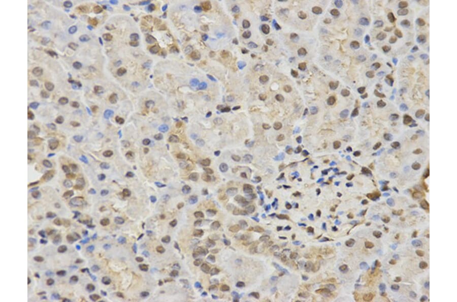 Immunohistochemistry - HDAC3 Antibody from Signalway Antibody (32620) - Antibodies.com