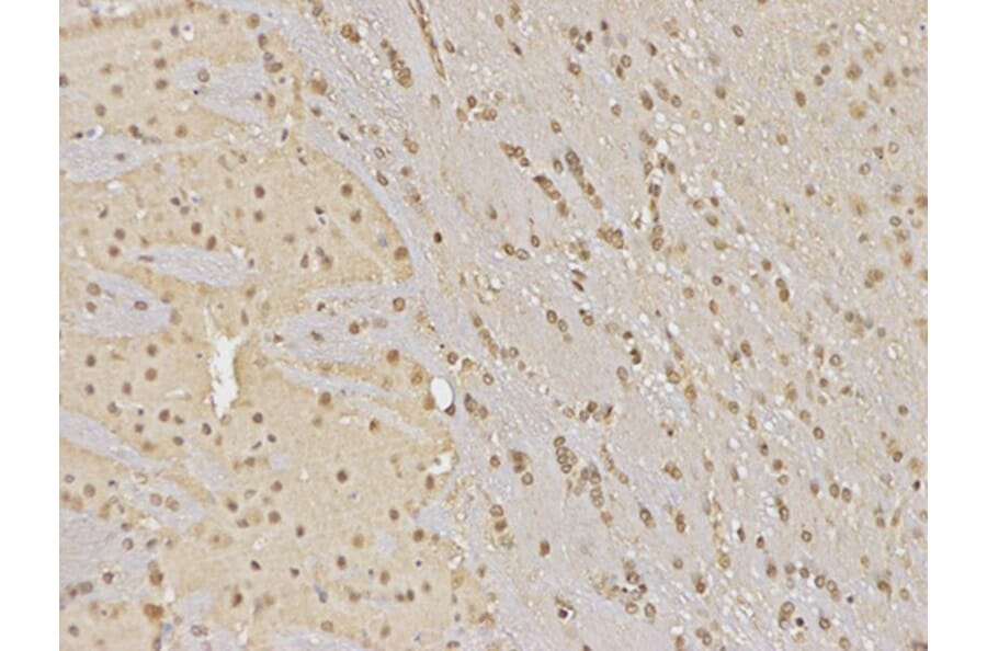 Immunohistochemistry - HDAC3 Antibody from Signalway Antibody (32620) - Antibodies.com