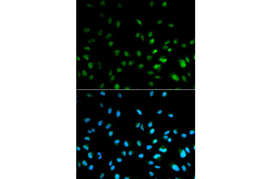 Immunofluorescence - HDAC3 Antibody from Signalway Antibody (32620) - Antibodies.com