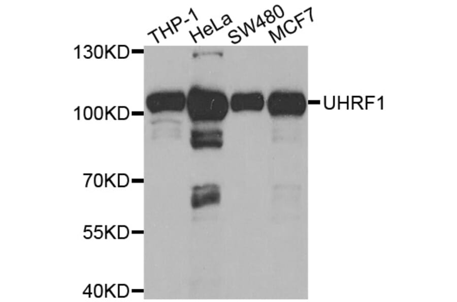 Western blot - UHRF1 Antibody from Signalway Antibody (32666) - Antibodies.com