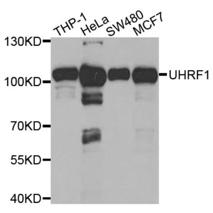 Western blot - UHRF1 Antibody from Signalway Antibody (32666) - Antibodies.com