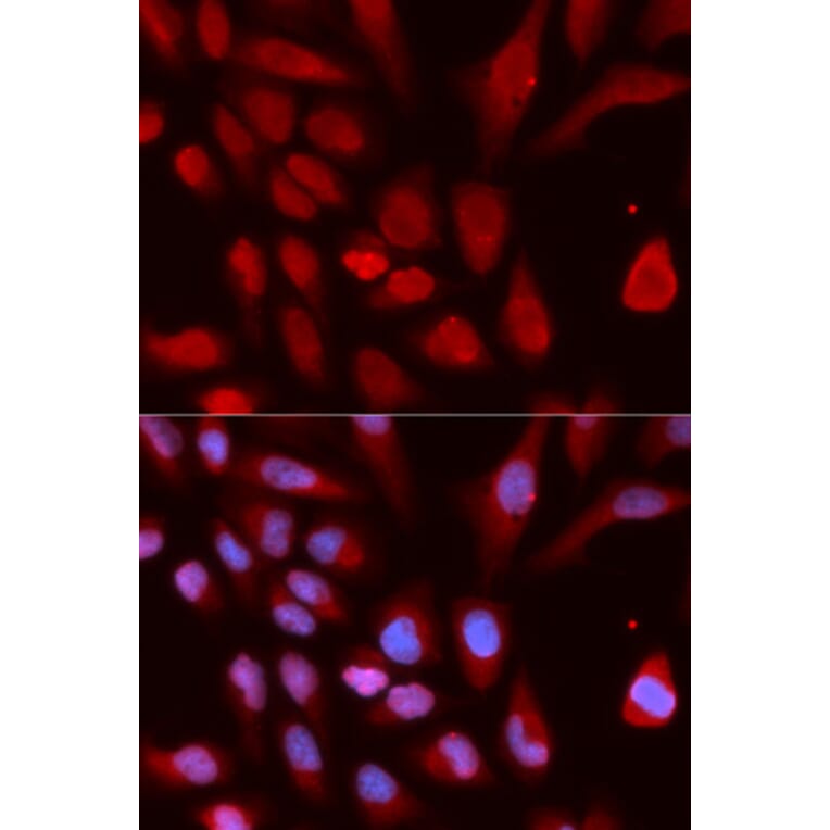Immunofluorescence - UHRF1 Antibody from Signalway Antibody (32666) - Antibodies.com