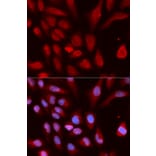 Immunofluorescence - UHRF1 Antibody from Signalway Antibody (32666) - Antibodies.com